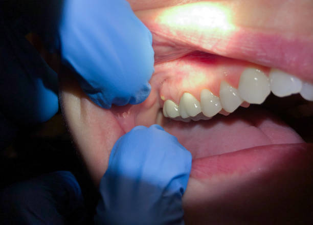 Best Walk-In Emergency Dental Services in Pineville, LA